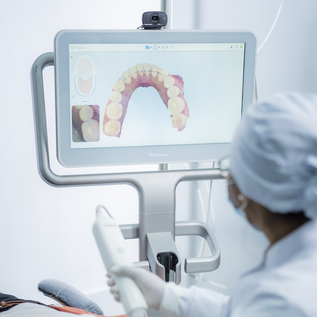 Escáner 3D Intraoral